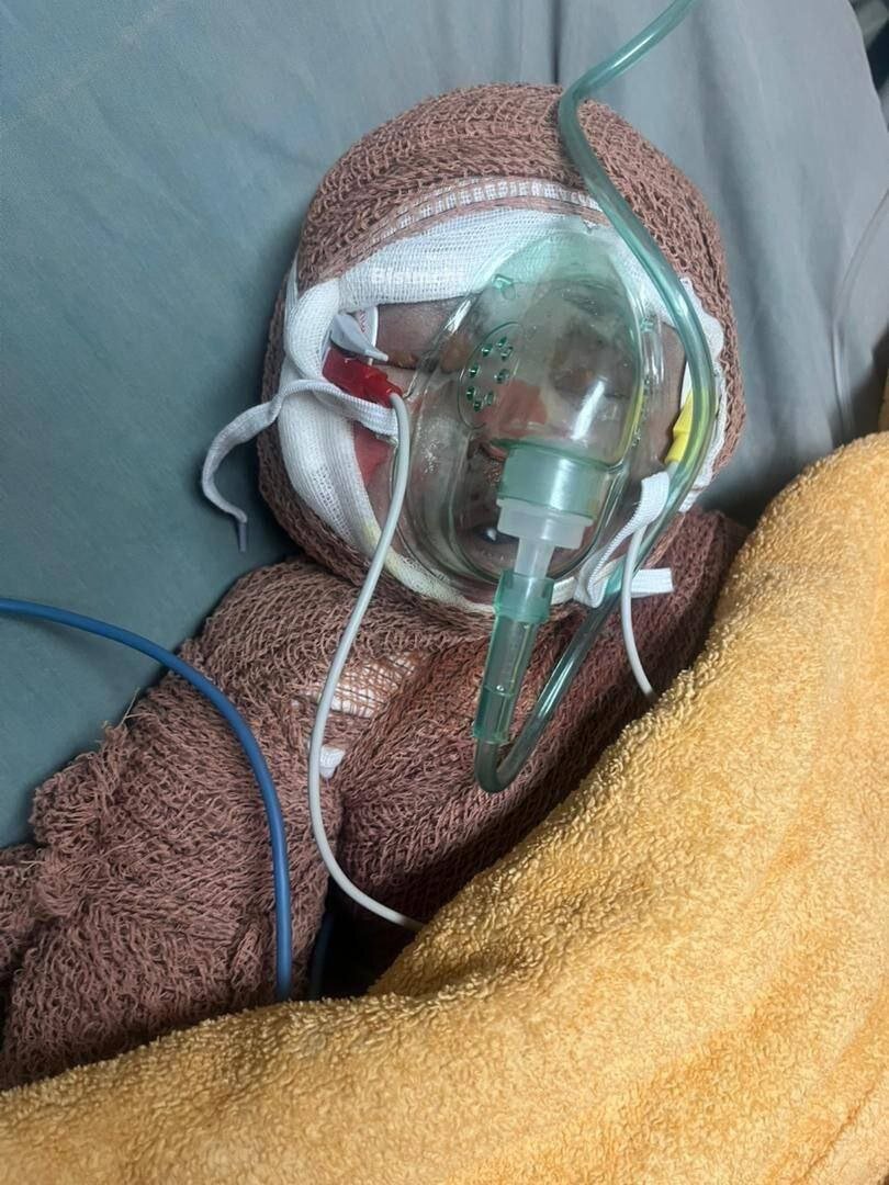 کوچکترین شهید ایران یاران قاسمیان دو ماهه