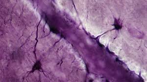 این سلولها خاطره میسازند | وقتی مغز ستارهگون نمایان میشود