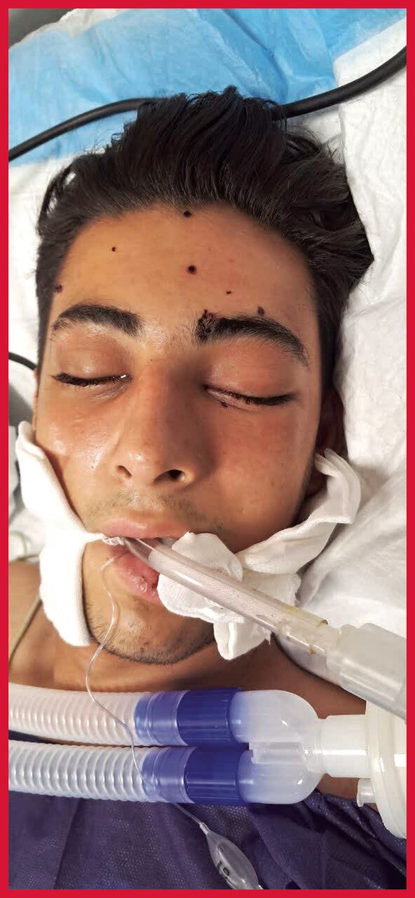 جنایت در اسلحهکشی نوجوانهای دهه هشتادی | اهدای اعضای پسر ۱۷ ساله پس از قتل + عکس