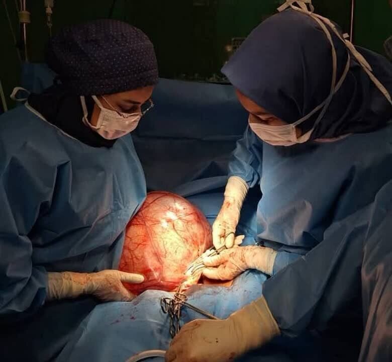 تومور ۲۰ کیلویی چطور داخل بدن یک انسان جا میشود؟ | بلایی که این تودهها بر سر اندامهای داخلی میآورند