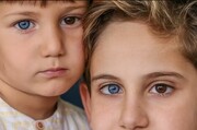چرا  چشم‌های برخی از افراد دو رنگ است؟