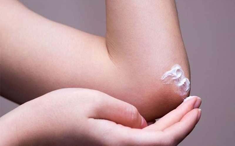 بهترین روشهای خانگی برای رفع تیرگی زانو و آرنج