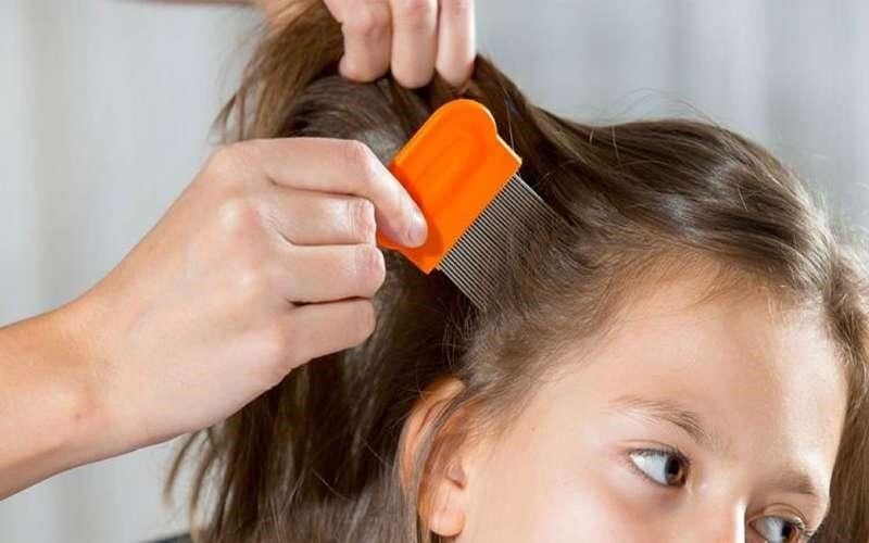 درمان شپش سر با پودر ماشین لباسشویی + عوارض