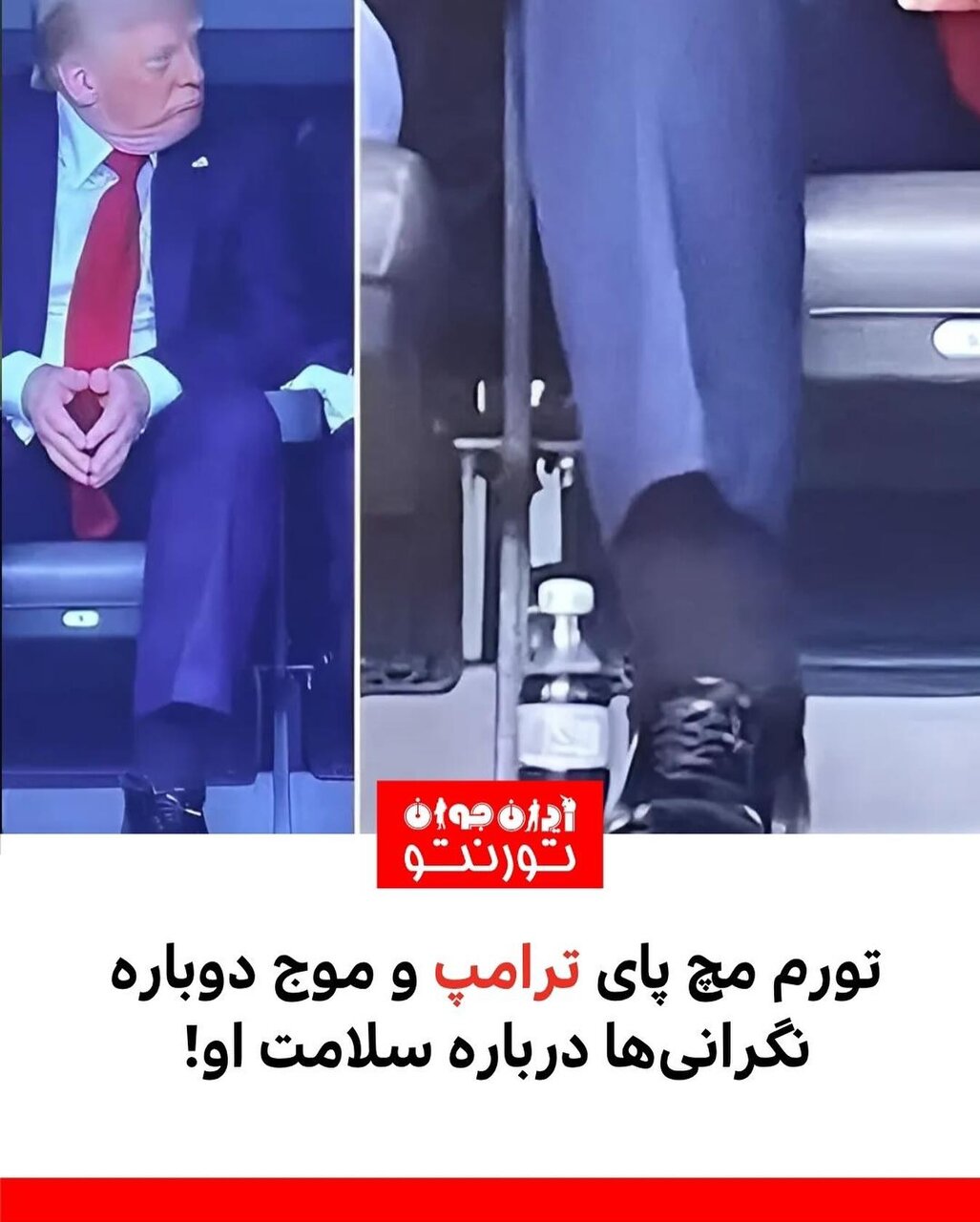 تورم مچ پای ترامپ خبر ساز شد؛ آیا او سکته کرده؟ + عکس