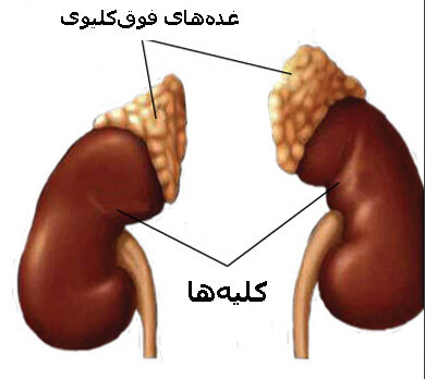 یکعلت فشار خون بالا که معمولا پزشکان نادیده میگیرند kidney
