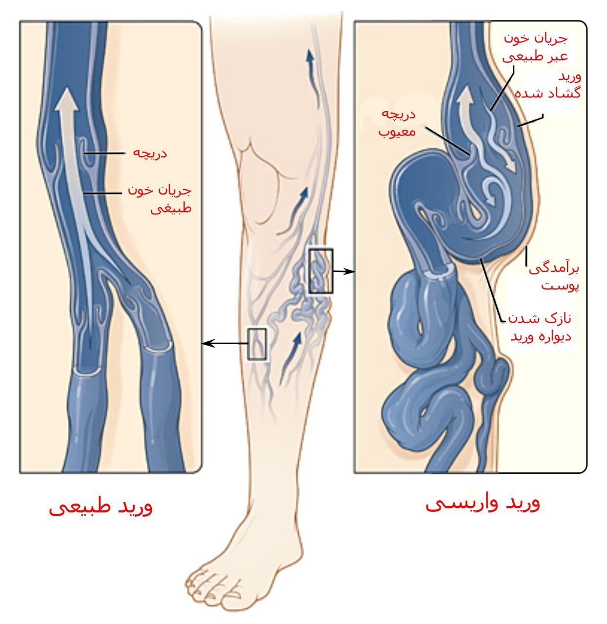 علت تورم پاهای دونالد ترامپ چیست؟