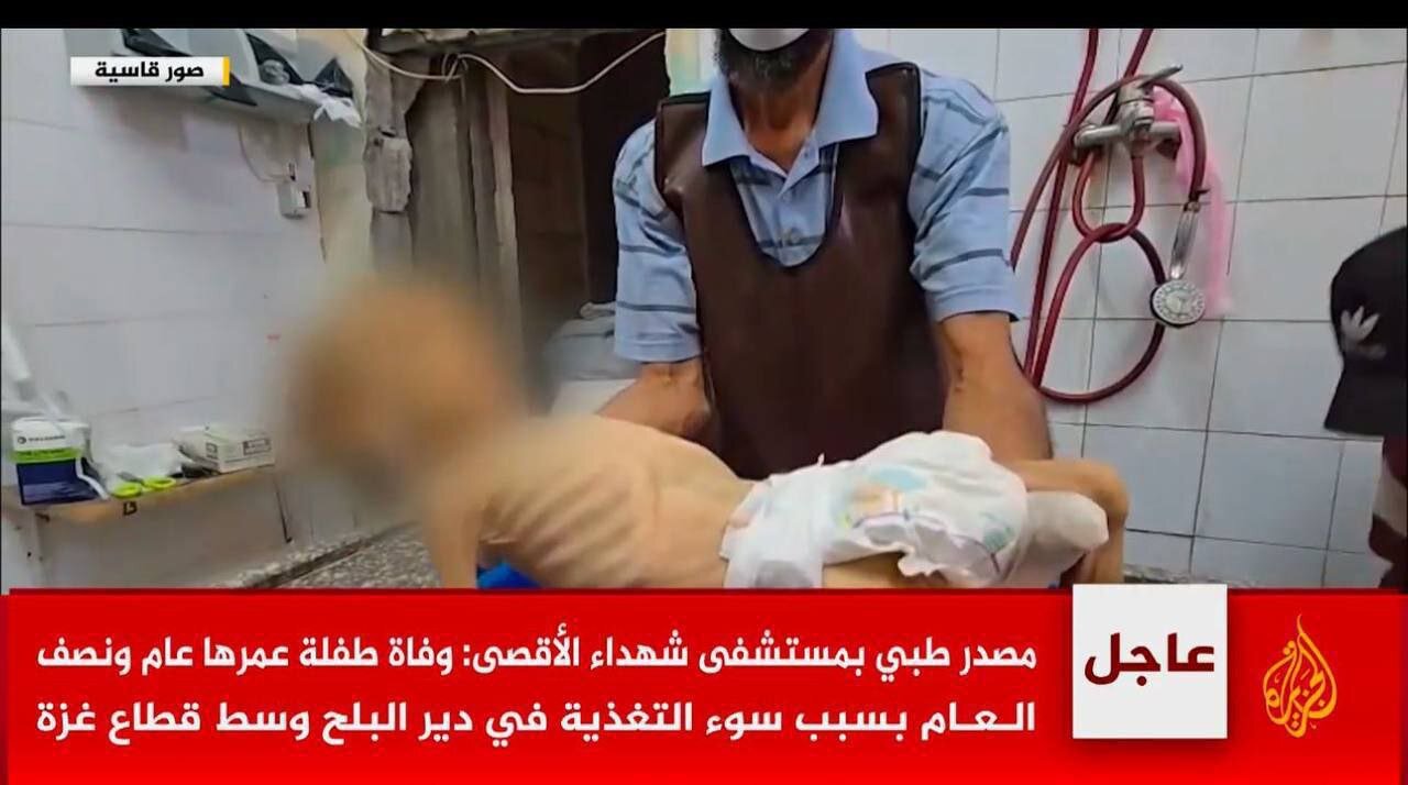 تصاویر وحشتناک از غزه که قلب را به درد میآورد | جان باختن کودکی دیگر در غزه بر اثر سوء تغذیه