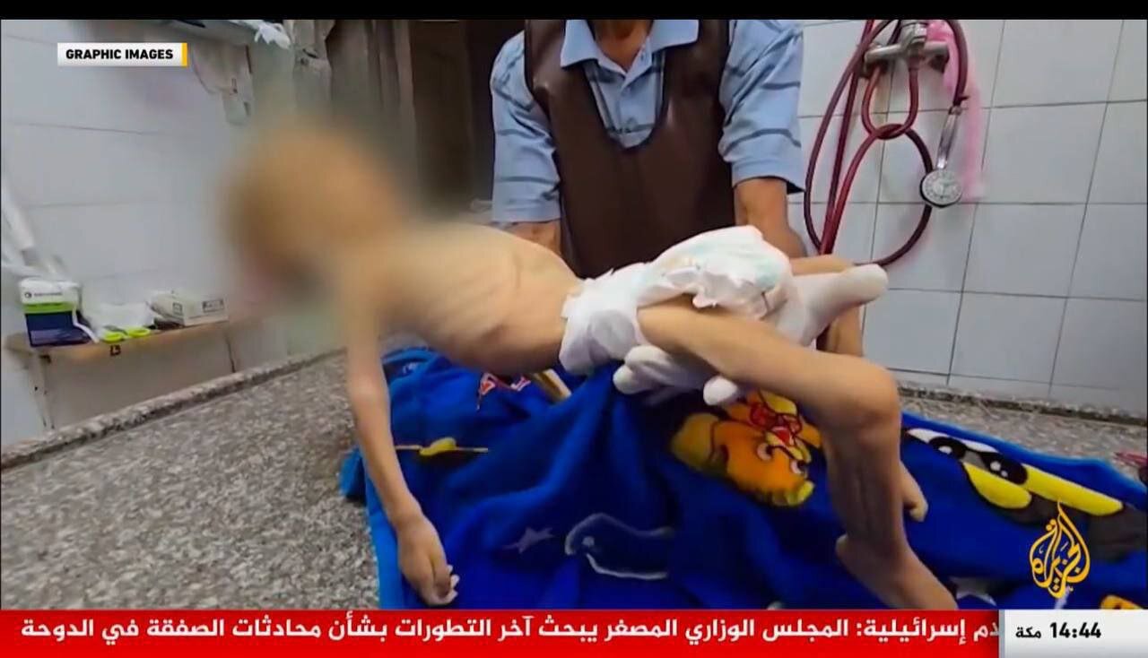 تصاویر وحشتناک از غزه که قلب را به درد میآورد | جان باختن کودکی دیگر در غزه بر اثر سوء تغذیه