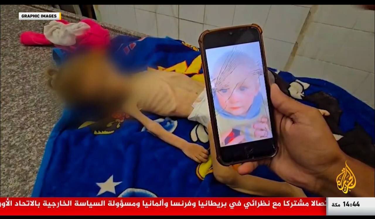 تصاویر وحشتناک از غزه که قلب را به درد میآورد | جان باختن کودکی دیگر در غزه بر اثر سوء تغذیه