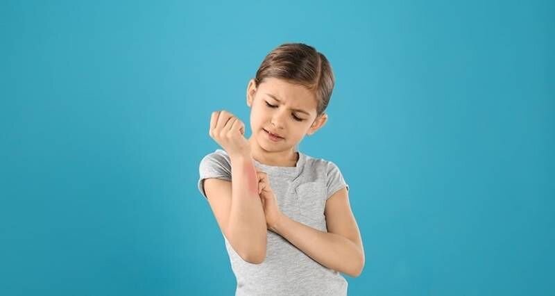 عرق سوز شدن