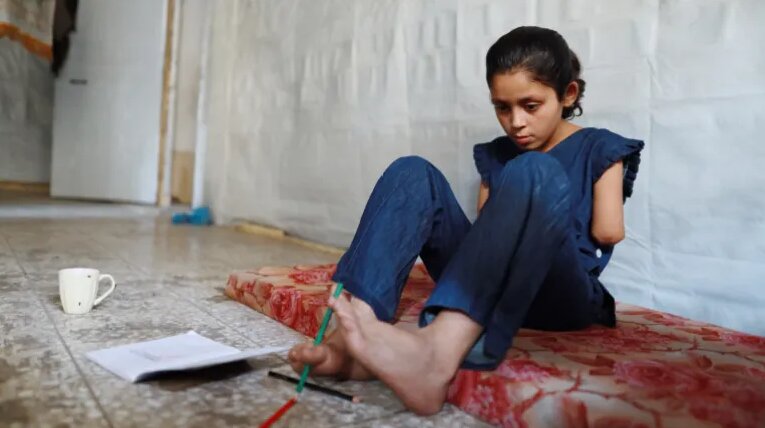 دستان این دختر را اسرائیل بریده است | او آرزو دارد پزشک شود | تصاویر