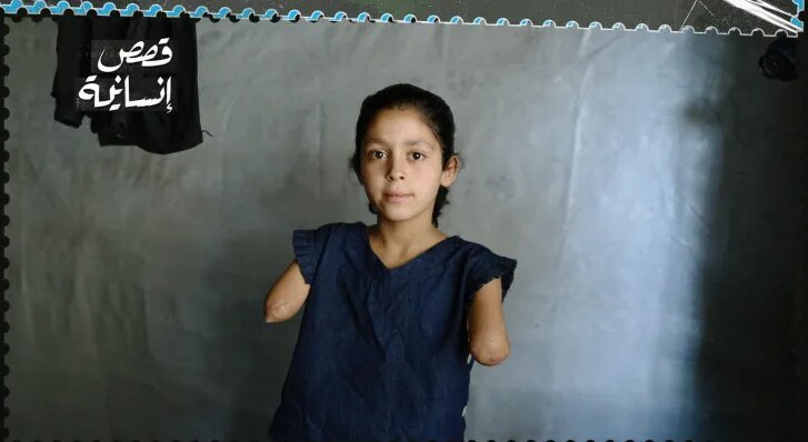 دستان این دختر را اسرائیل بریده است | او آرزو دارد پزشک شود | تصاویر