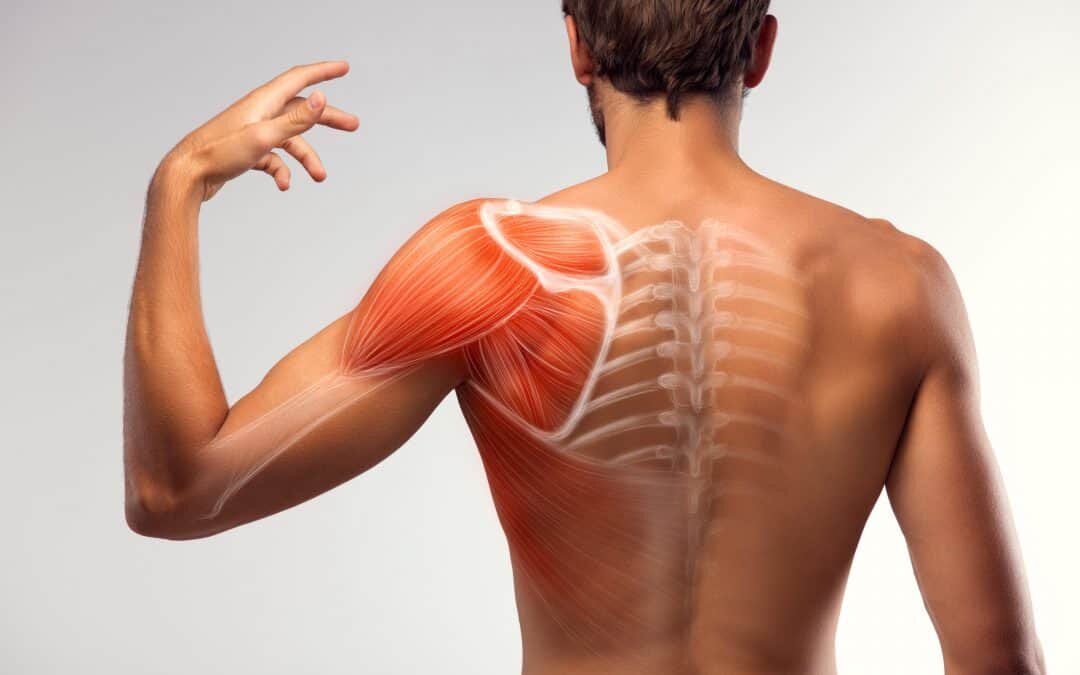 دررفتگی مکرر شانه چیست - shoulder dislocation