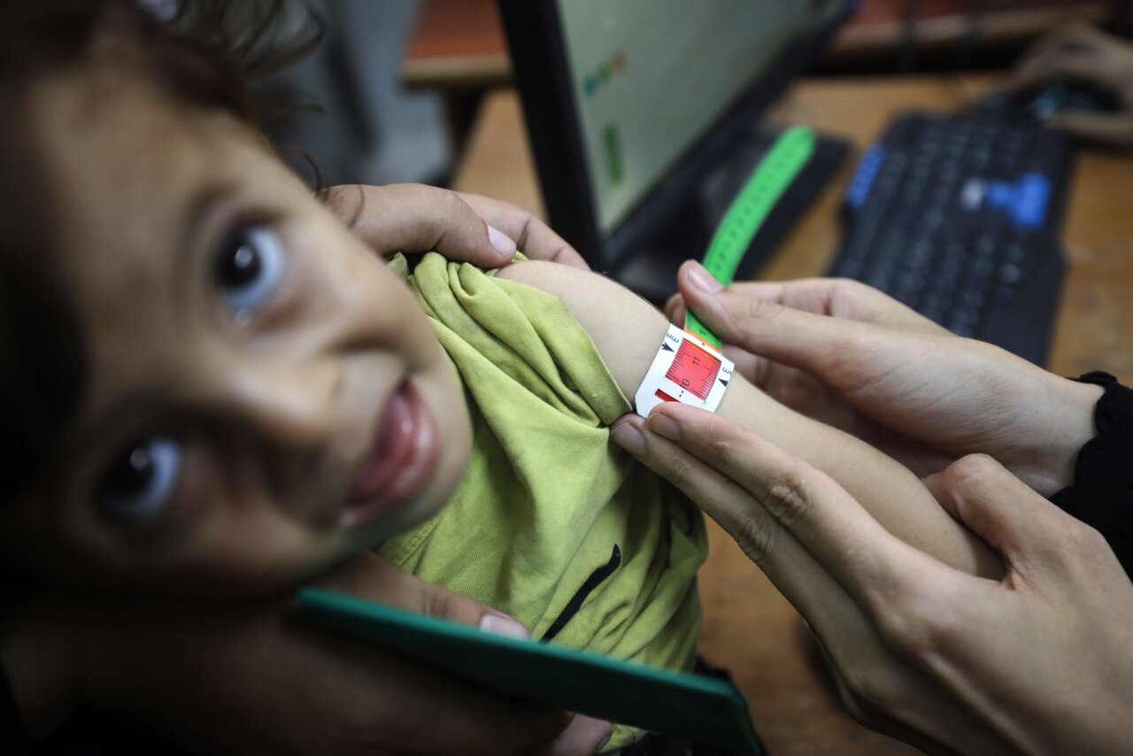 ۱۲ قاب دردناک از غزه؛ ببینید | تصاویر سیانان از وضعیت دهشتناک انسانی در غزه