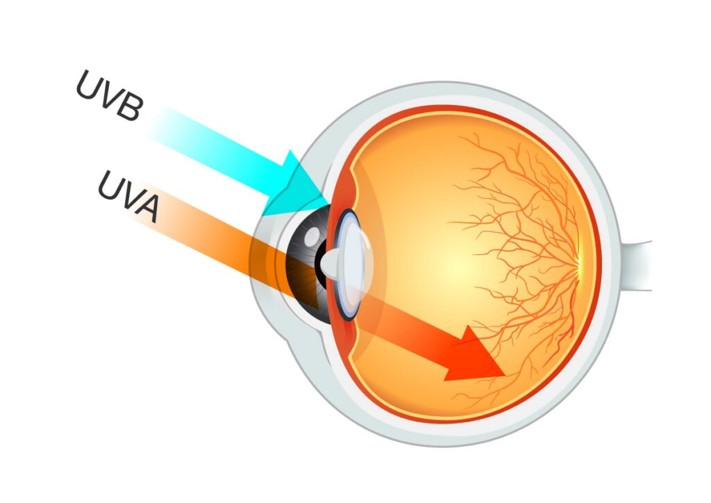 اشعه ماورا بنفش باعث چه بیماری‌هایی می‌شود ؟ + راهکارهای محافظتی در برابر اشعه UV