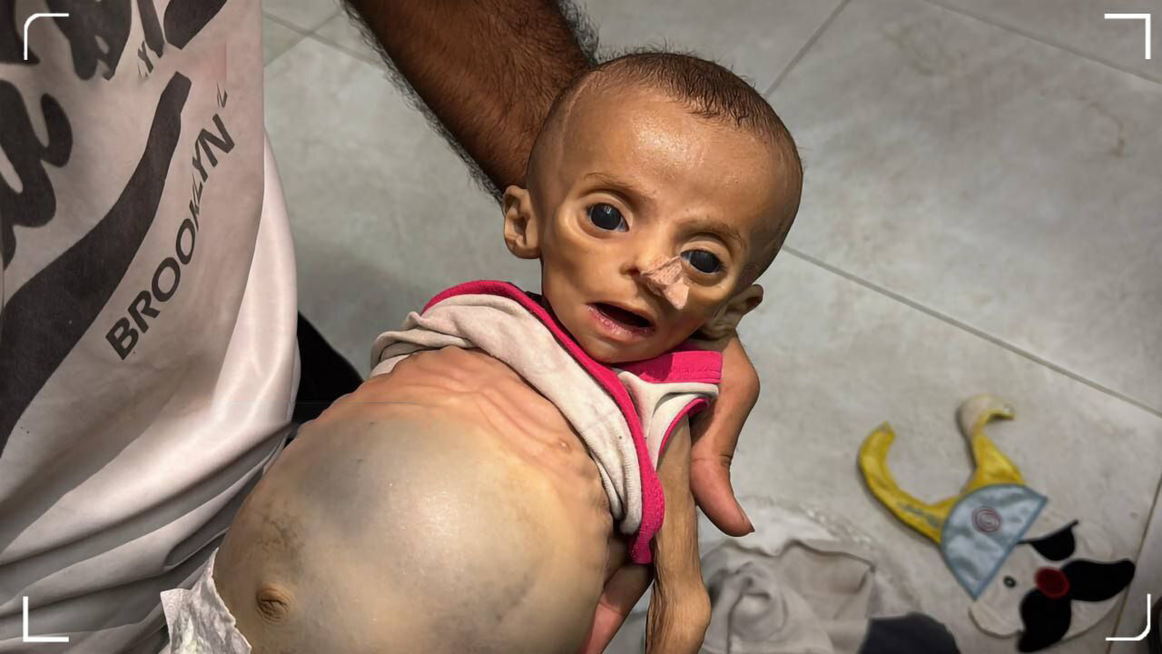 تصاویر تلخ از شهادت ۳ نوزاد گرسنه در غزه طی ۲۴ ساعت اخیر | تصاویر