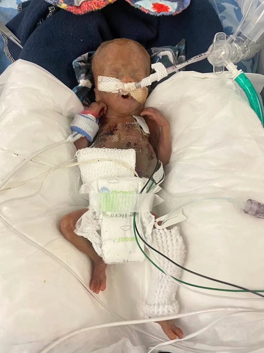 زوردرسترین نوزاد جهان به دنیا آمد