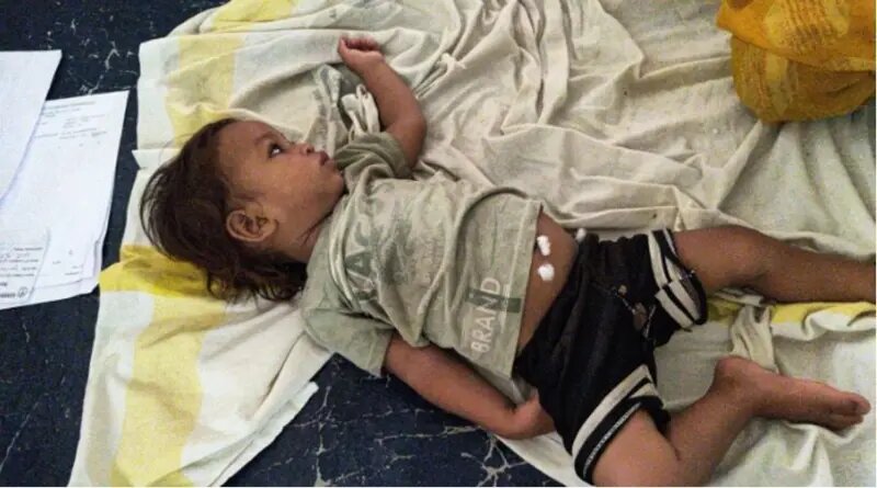 نوزاد هندی با دندانهایش مار کبرا را کُشت و خود را نجات داد + عکس