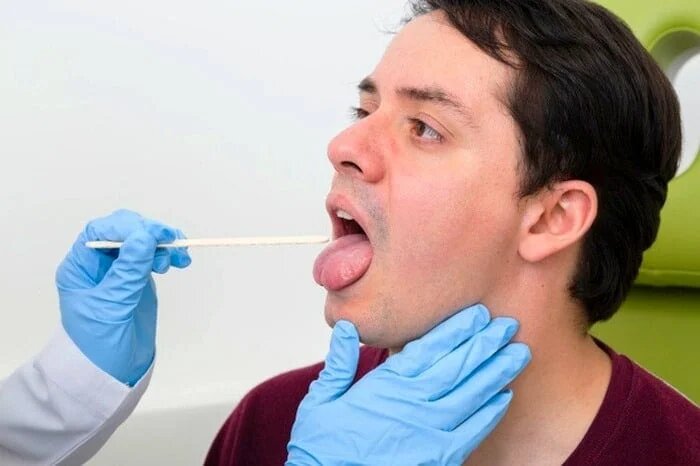 علائم خطرناک سوزش زبان که بیانگر بیماری جدی در بدن است