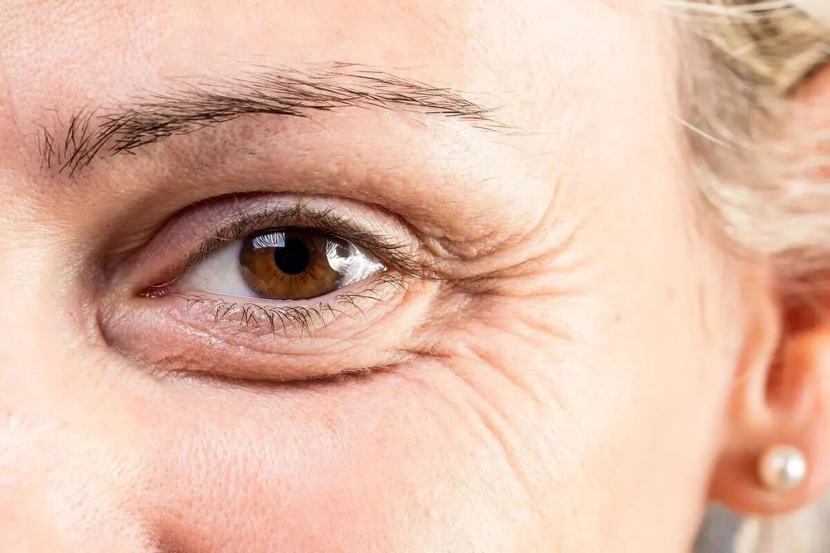 با مصرف این ۶ خوراکی زود پیر میشوید و پوستتان نابود میشود