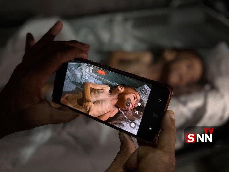 محمد ۵ ساله در غزه با وزن ۳ کیلوگرم جان داد؛ نماد دردناک قحطی و بیتوجهی جهانی