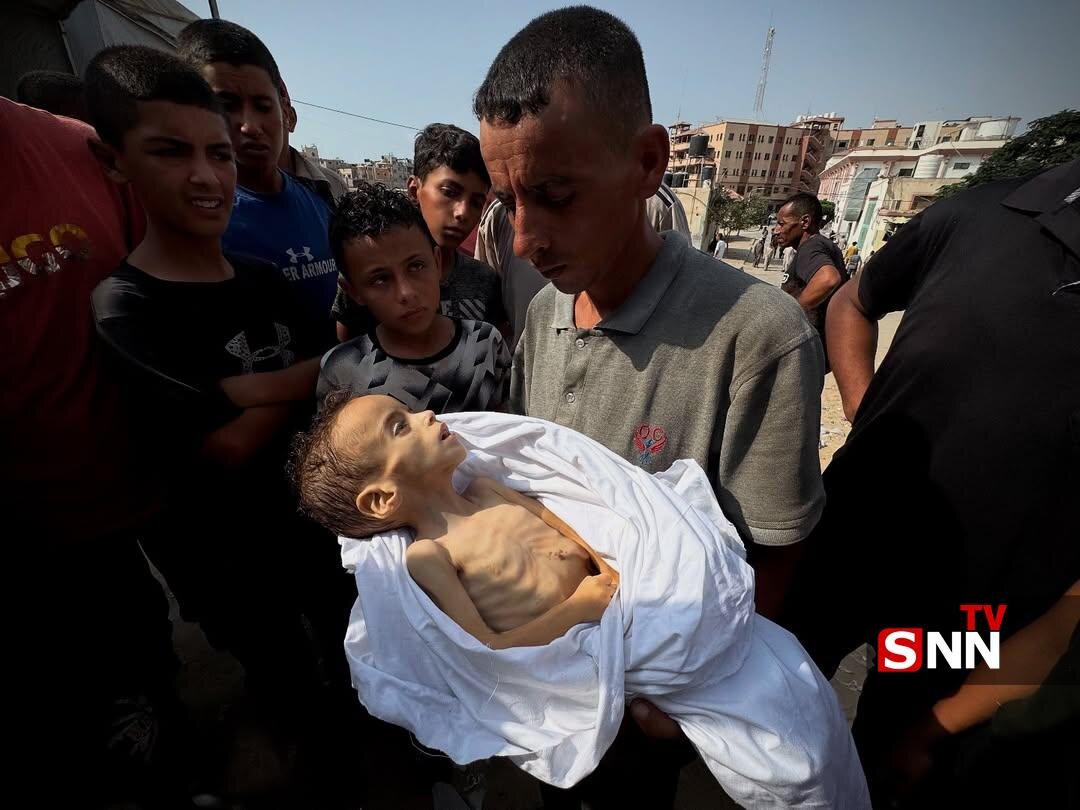 محمد ۵ ساله در غزه با وزن ۳ کیلوگرم جان داد؛ نماد دردناک قحطی و بیتوجهی جهانی