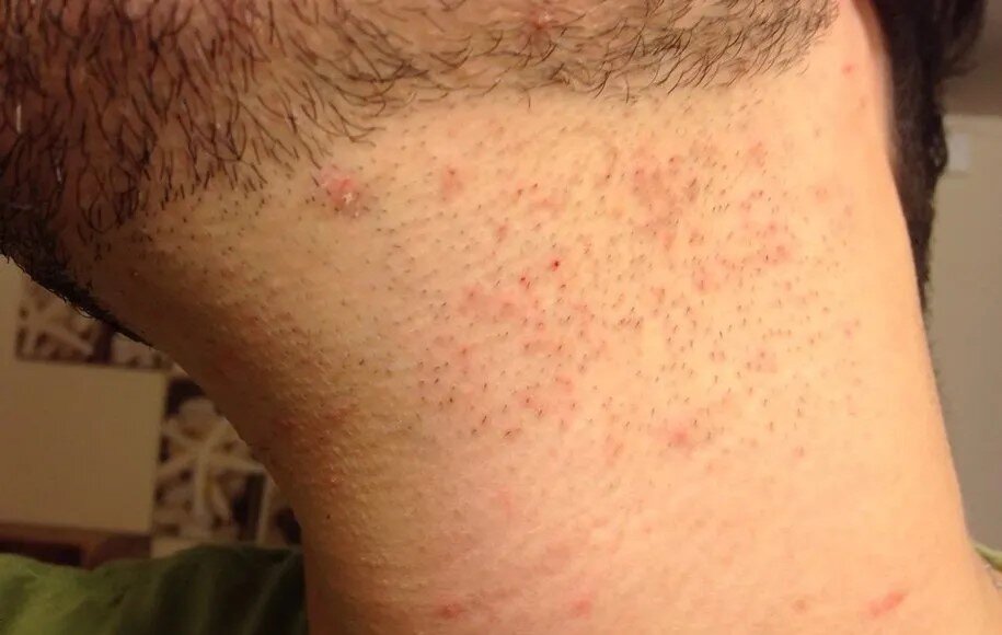 نکات مهم اصلاح صورت با ژیلت برای جلوگیری از التهاب و بریدگی