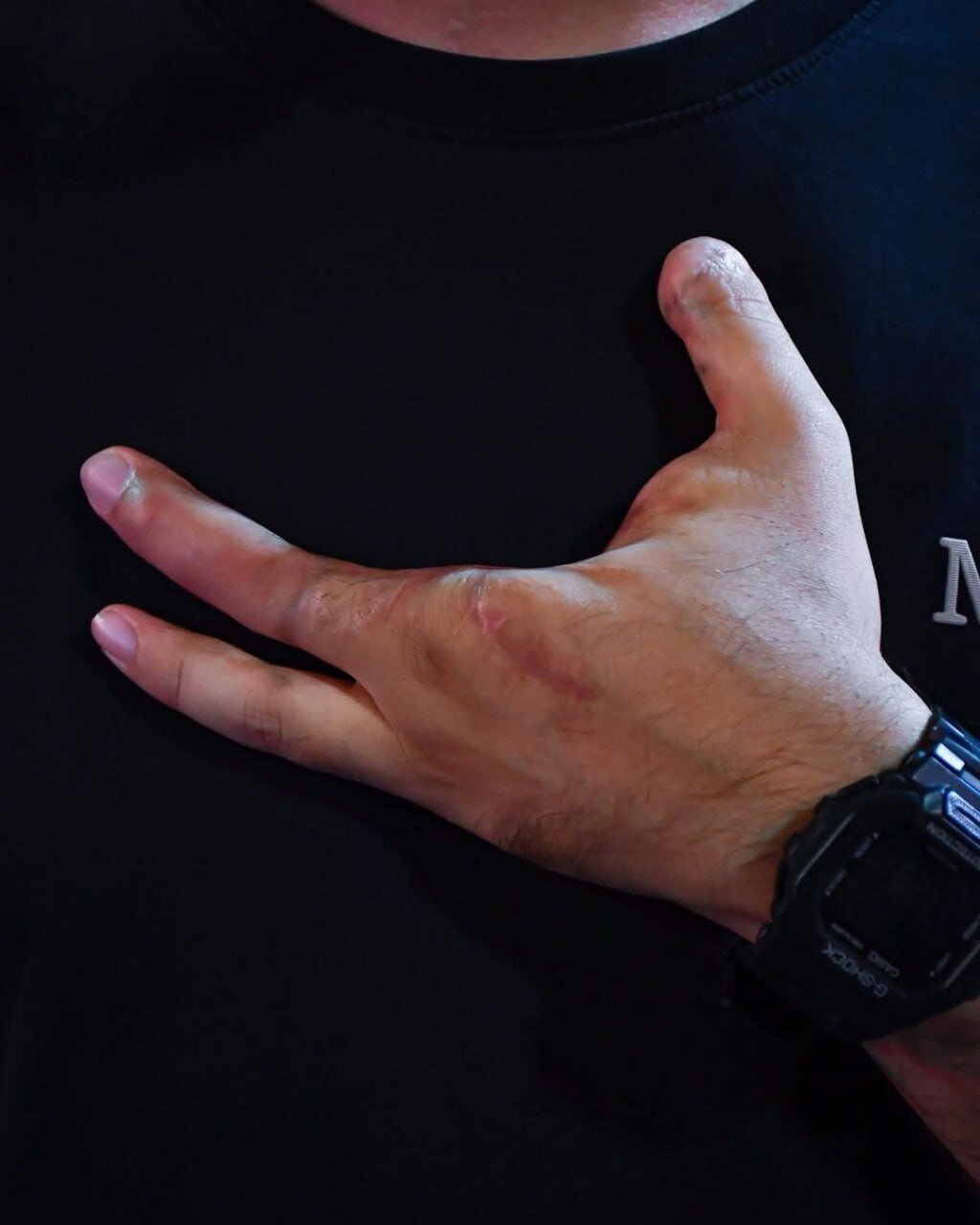 جانبازان پیجری حزب الله در کربلا | تصاویر