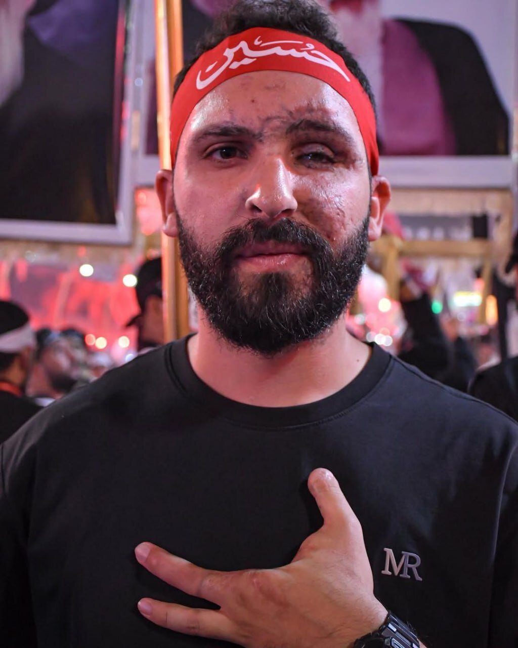 جانبازان پیجری حزب الله در کربلا | تصاویر