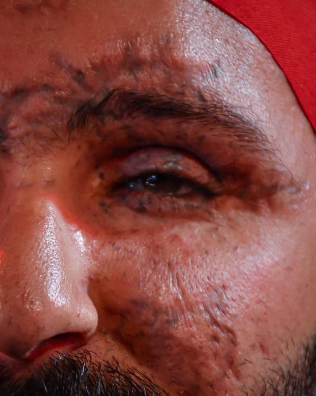 جانبازان پیجری حزب الله در کربلا | تصاویر