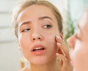 روش‌های طبیعی برای رفع خشکی پوست در دوران بارداری