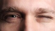 اولین زنگ خطر کوری در دیابت؛ این علائم را جدی بگیرید
