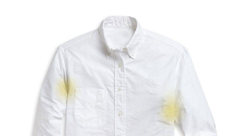 روشهای موثر برای جلوگیری از زرد شدن لباسهای سفید در خانه