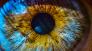 وداع با لیزر؟ | اصلاح بینایی بدون برش قرنیه ممکن شد