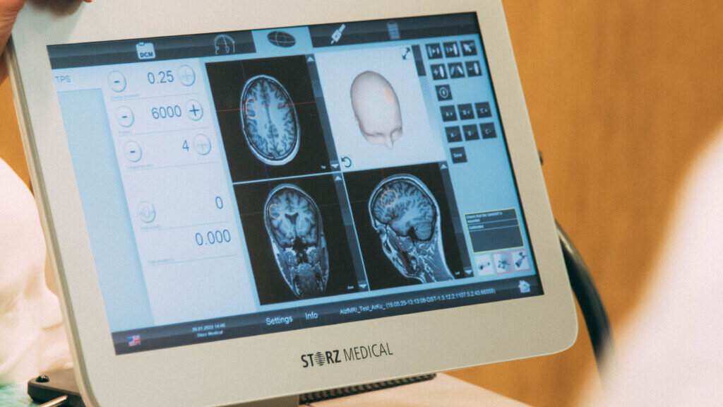 کشف اسرار نهفته در مغز | مشاهده مسیرهای عصبی، تعاملات سلولی و حتی تغییرات مولکولی