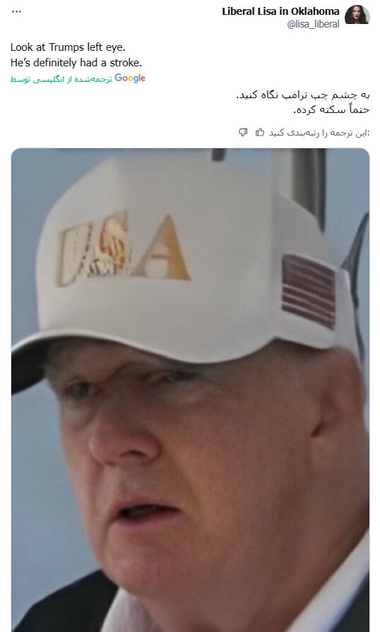 چهره جدید ترامپ جنجالی شد+ تصاویر | صورت او ضربه شدیدی خورده یا این ترامپ نیست! | احتمال دارد وی سکته کرده باشد...