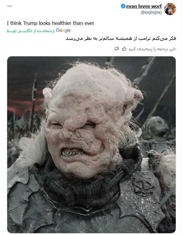 چهره جدید ترامپ جنجالی شد+ تصاویر | صورت او ضربه شدیدی خورده یا این ترامپ نیست! | احتمال دارد وی سکته کرده باشد...