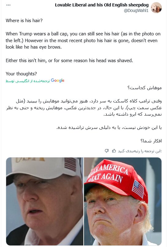 چهره جدید ترامپ جنجالی شد+ تصاویر | صورت او ضربه شدیدی خورده یا این ترامپ نیست! | احتمال دارد وی سکته کرده باشد...