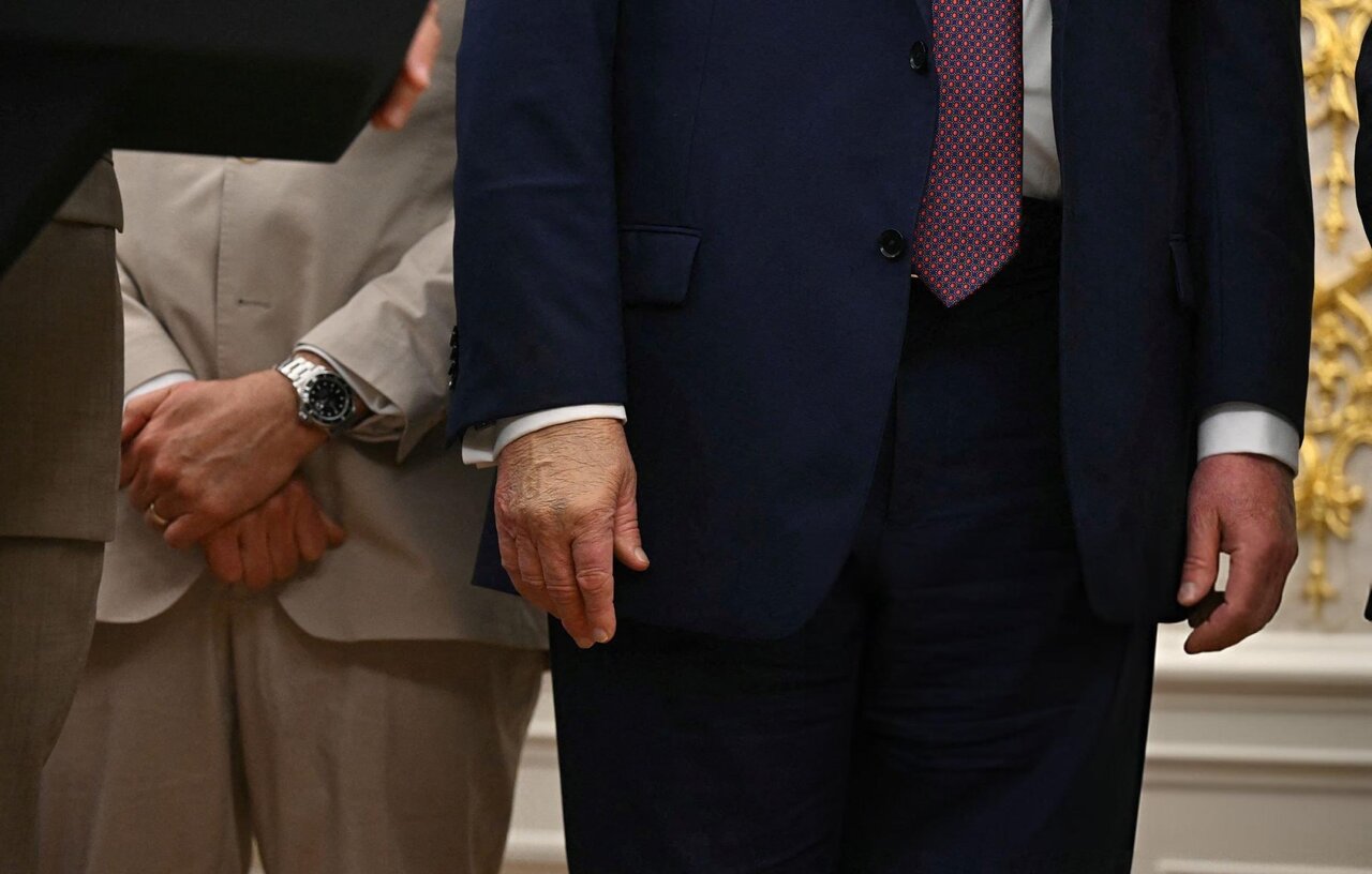 دست راست گریم شده ترامپ در نشست خبری کاخ سفید | تصاویر