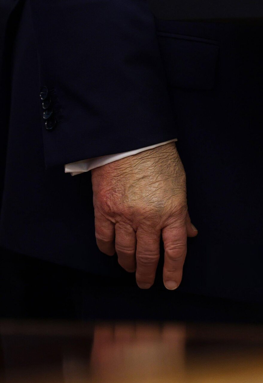 دست راست گریم شده ترامپ در نشست خبری کاخ سفید | تصاویر