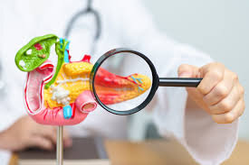 تحولی بزرگ در دنیای علم و پزشکی نوین | پایان سکوت خاموشترین سرطان؛ تشخیص فقط با یک قطره خون