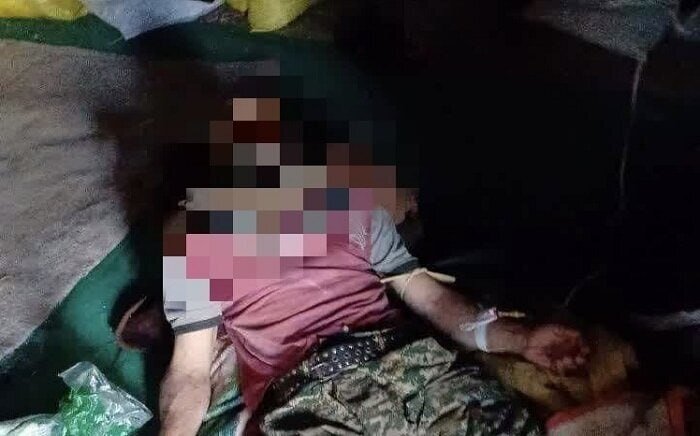 حمله خرس به نوجوان ۱۶ ساله + عکس