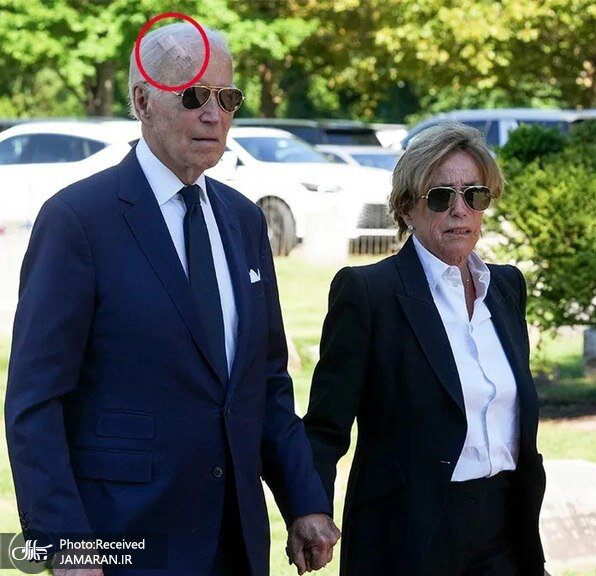 پس از ترامپ نوبت بیماری بایدن شد؛ زخم بزرگ روی سرش را ببینید | وضعیت او وخیم است؟