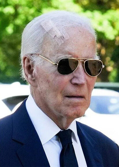 پس از ترامپ نوبت بیماری بایدن شد؛ زخم بزرگ روی سرش را ببینید | وضعیت او وخیم است؟