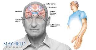همکاری ۶۰۰ هزار نورون مغز فقط برای یک تصمیمگیری یا انتخاب ساده