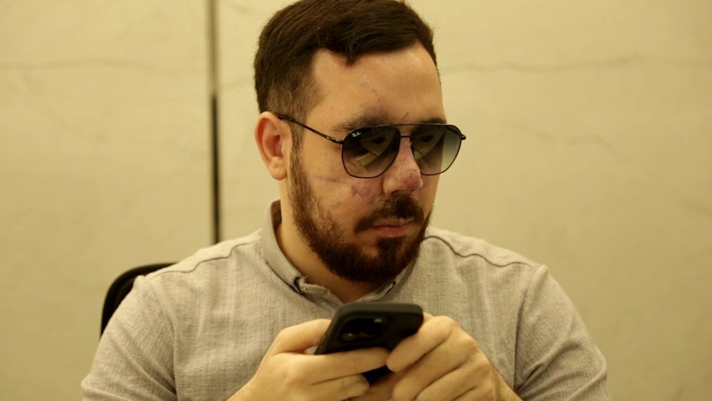 زندگی جدید مجروحهای پیجری | مجروحان حمله پیجری در یک سال گذشته چه کردند؟