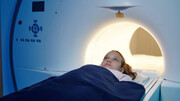 تصویربرداری پزشکی خطر سرطان خون کودکان را بالا می‌برد