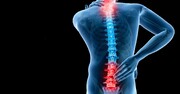 مراقبت‌های دیسک کمر و نکات مهم برای کسانی که دیسک کمر دارند