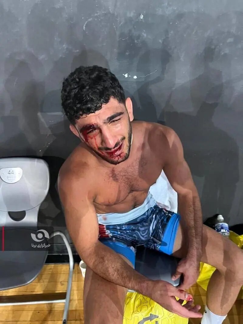 تصاویری از وضعیت دردناک دانیال سهرابی پس از شکست برابر غانم فرانسوی