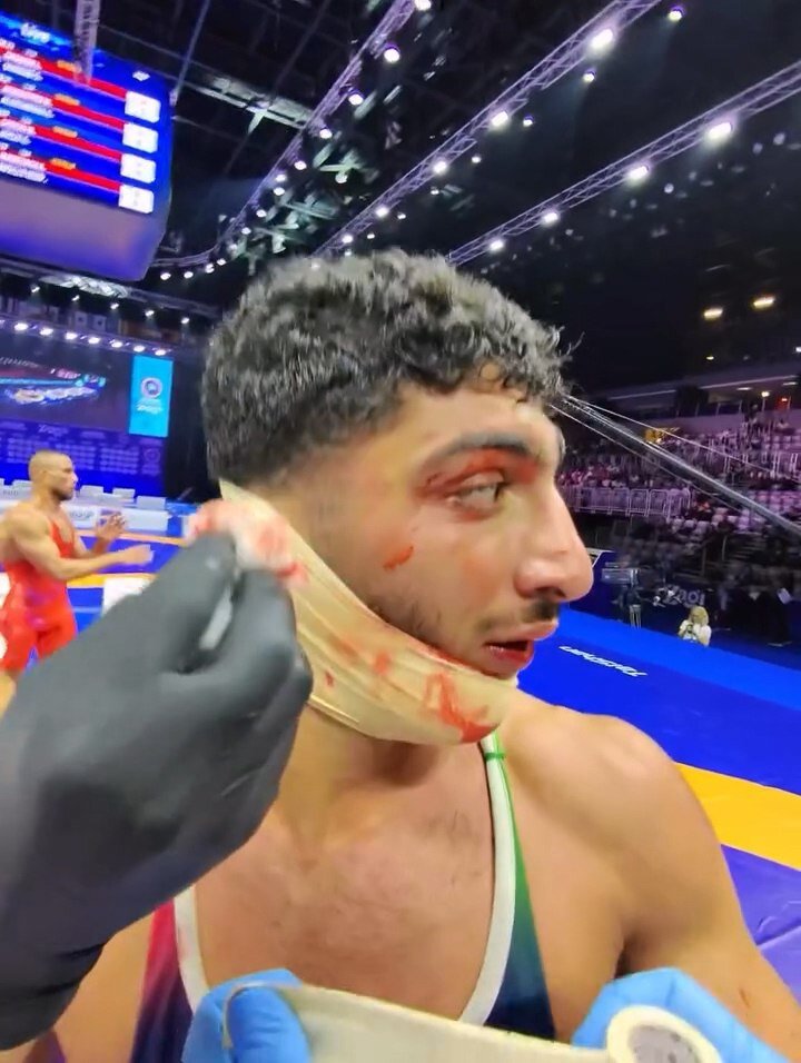 افشاگری دکتر شایگان از شکست جنجالی سهرابی: گفتم نرو میبازی + تصاویر | تایید ضربه عمدی رقیب